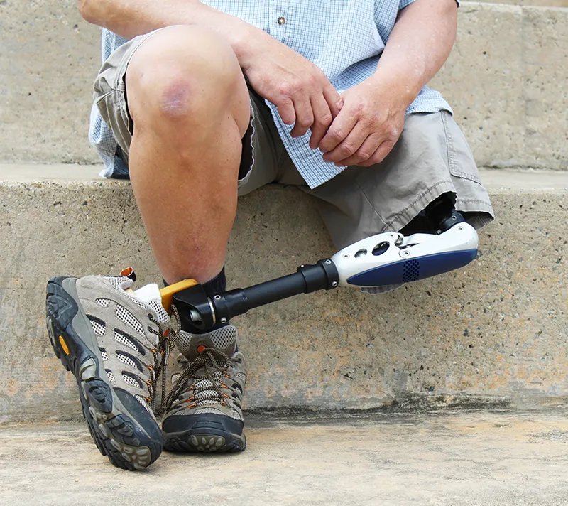 Guy sitting on steps with prosthetic leg